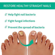Fast Nail Fungus Treatment Serum | Nail Repair Essence for Fingernails & Toenails | Natural Nail Care Formula