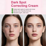 Arbutin 7% + Tranexamic Acid 4% Cream | Brightening Moisturizer for Dark Spots, Uneven Tone & Hydration | 50g